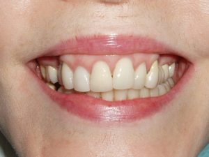 Smile gallery 2