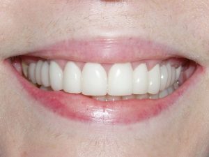 Smile gallery 3